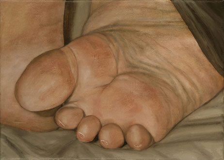 osberts foot by patrice moor